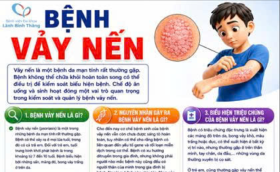 Bệnh vảy nến
