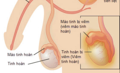 Tinh hoàn: cấu tạo, vai trò chức năng và các bệnh thường gặp ở nam giới
