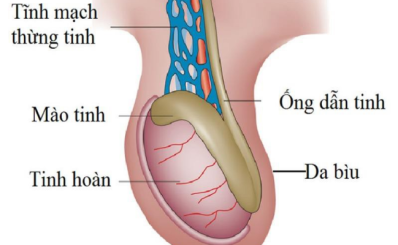 Đau tinh hoàn: triệu chứng, nguyên nhân, phòng ngừa và điều trị