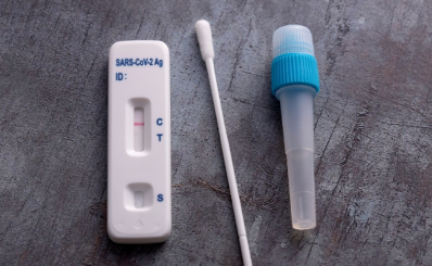 Chữ T chữ C trên que thử test nhanh Covid 19 nghĩa là gì?
