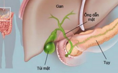 Viêm tụy cấp: nguyên nhân, triệu chứng, điều trị và phòng ngừa