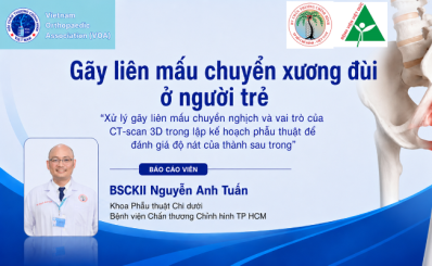 Gãy liên mấu chuyển xương đùi ở người trẻ