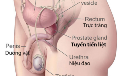Ung thư tuyến tiền liệt: dấu hiệu, nguyên nhân, chẩn đoán và điều trị hiệu quả