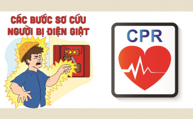 Các bước sơ cứu người bị điện giật