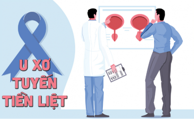 U xơ tuyến tiền liệt