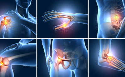 Đau nhức xương khớp toàn thân: dấu hiệu, nguyên nhân, phân loại, điều trị, phòng tránh