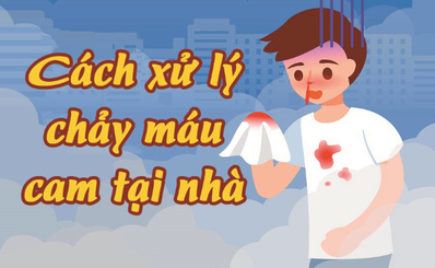 Cách xử lý chảy máu cam tại nhà