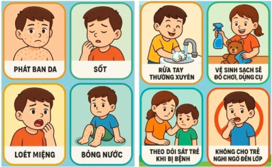 Sở Y tế TP.HCM cảnh báo tác nhân EV71 xuất hiện trở lại