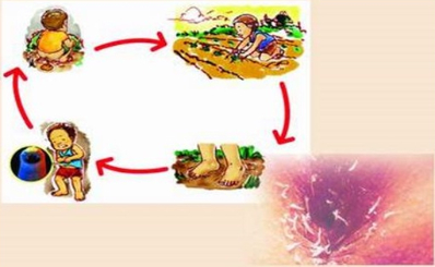 Nhiễm giun - Mối đe dọa sức khỏe trẻ em