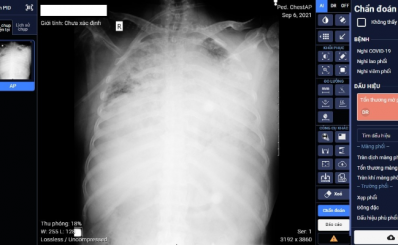 Sản phẩm tuyên truyền CCHC Quý III/2021: 