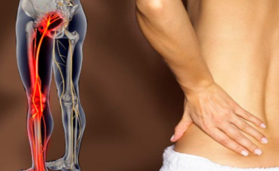 Đau thần kinh tọa: Dấu hiệu, nguyên nhân, điều trị, dự phòng