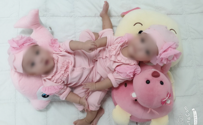 Bệnh viện Nhi đồng Thành phố báo cáo phẫu thuật tách dính ca song sinh phức tạp.