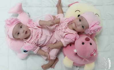 Sẵn sàng cho ca mổ tách dính phức tạp đầu tiên tại Bệnh viện Nhi đồng Thành phố