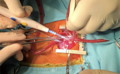 TP Hồ Chí Minh: Các bệnh viện mổ tim không thiếu thuốc Protamin sulfat