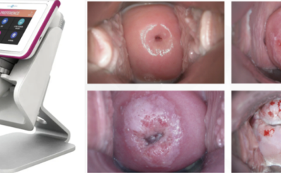 Sở Y tế TPHCM: Thêm một ứng dụng AI được triển khai tại Trạm y tế xã đảo Thạnh An