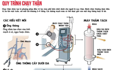 Chạy thận là gì? Nguyên nhân phải chạy thận