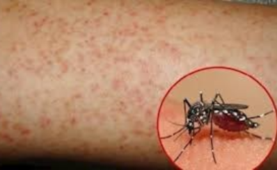 Làm rõ thêm thông tin phản ánh trên báo Tuổi trẻ ngày 8/11/2022 về bác sĩ kê đơn thực phẩm chức năng cho bệnh nhân sốt xuất huyết