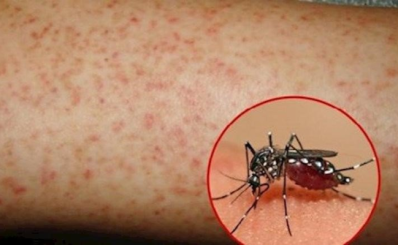 Thành phố Hồ Chí Minh: Triển khai quyết liệt các biện pháp phòng chống dịch bệnh trong tháng 6 năm 2023
