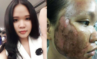 Hãy tỉnh táo khi dùng các loại mỹ phẩm làm đẹp nhé mọi người!