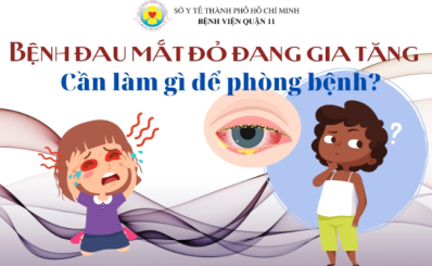 Bệnh đau mắt đỏ đang gia tăng, cần làm gì để phòng bệnh?