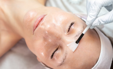 CHĂM SÓC SAU DỊCH VỤ  TÁI TẠO DA BẰNG HÓA CHẤT (PEEL DA)
