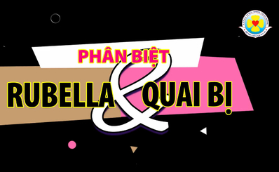 Phân biệt Rubella và quai bị
