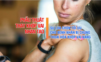 Giải pháp cho bệnh nhân bị chứng thoái hóa khớp vai nặng