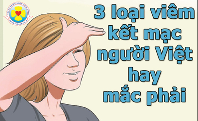 3 loại viêm kết mạc người Việt hay mắc phải