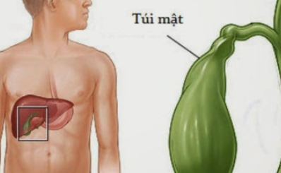 Viêm túi mật là gì? Dấu hiệu, nguyên nhân, điều trị, chẩn đoán và phòng ngừa